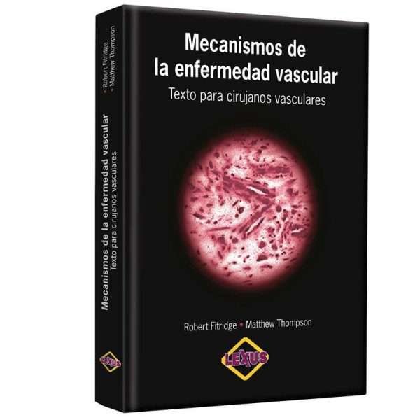Mecanismo de la Enfermedad Vascular