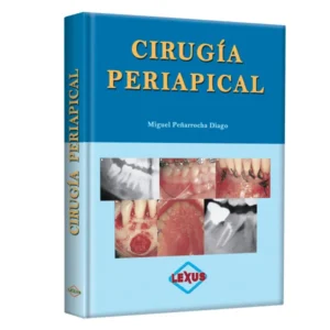 Manual Peñarrocha Cirugía Periapical