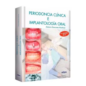 Manual de Periodoncia Clínica e Implantología Oral