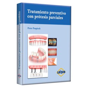 Manual Tratado Preventivo con Prótesis Parciales